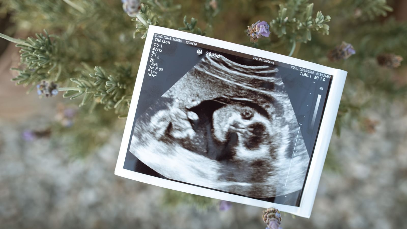 Kaley Cuoco, Tom Pelphrey Expect Second Baby Girl